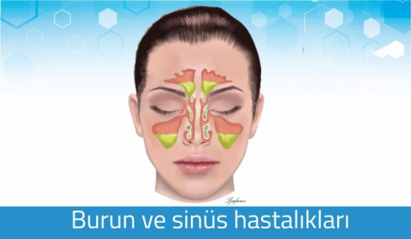 SORU CEVAPLARLA BURUN-SİNÜS HASTALIKLARI